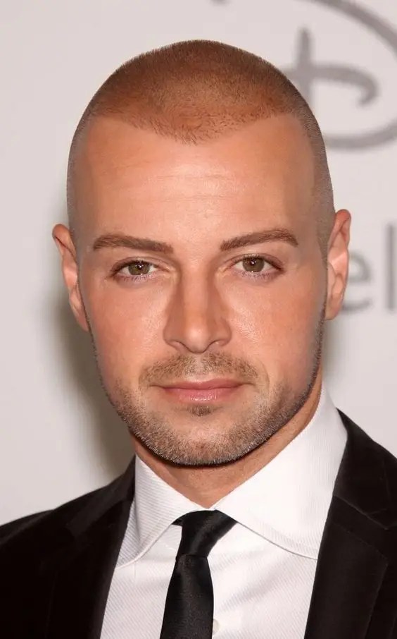 A man with a receding hairline wearing a low cut