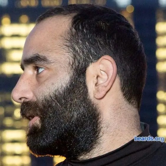 A profile view of a man with a full neck beard.
