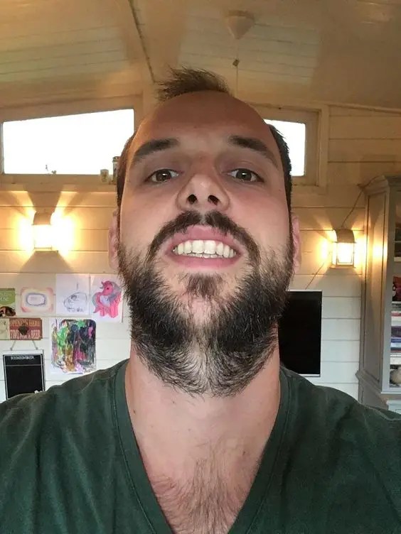 A man showing off a full-neck beard around his neckline.