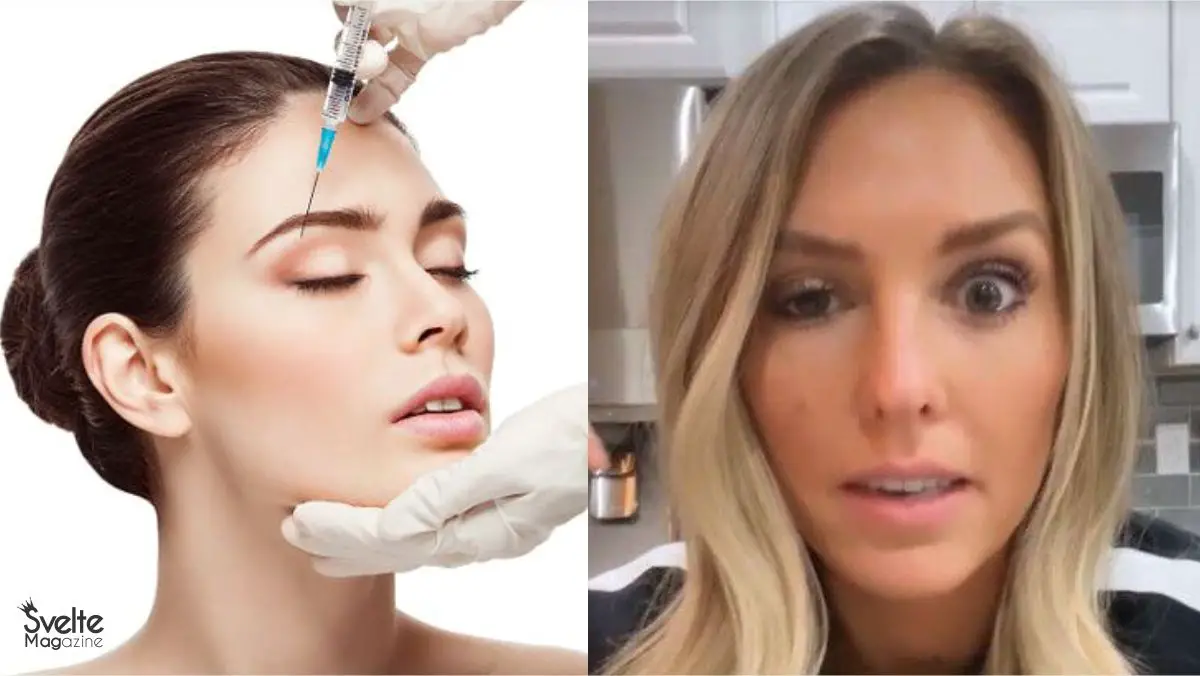 Botox Under Eyes: What You Didn’t Know About This Procedure